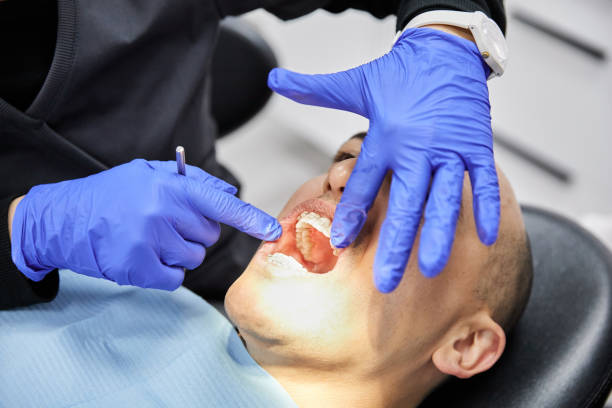 Best Emergency Dental Care for Sports Injuries in Sigourney, IA