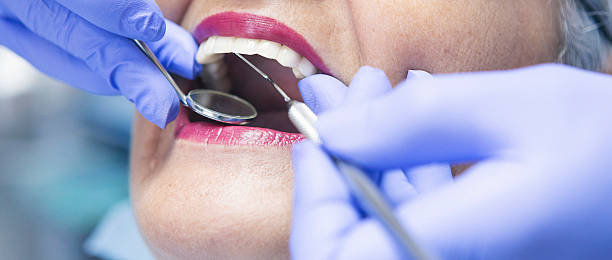 Best Emergency Wisdom Tooth Extraction in Sigourney, IA
